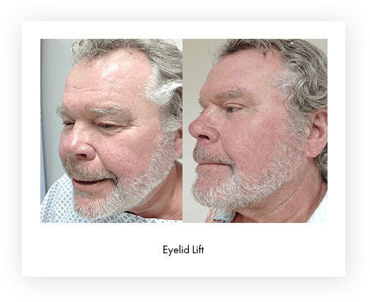 Before and after