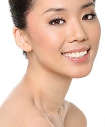 portrait of a woman after necklift procedure