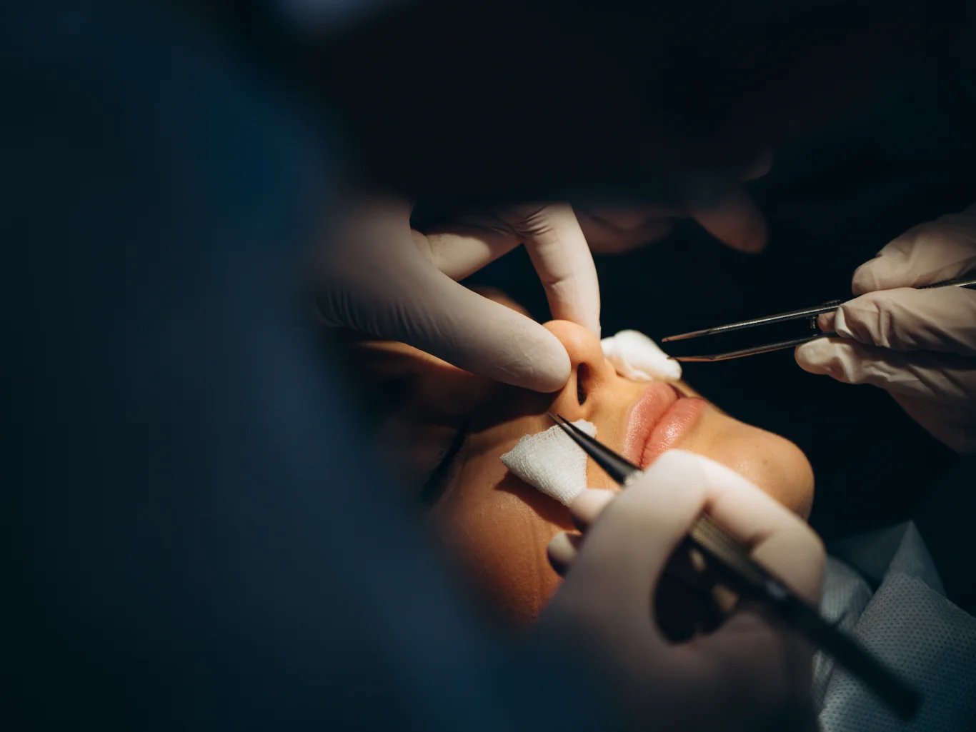 nose reshaping augmentation surgeon and his assistant performing cosmetic surgery on nose in hospital operating room