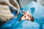 Functional Rhinoplasty for Breathing
