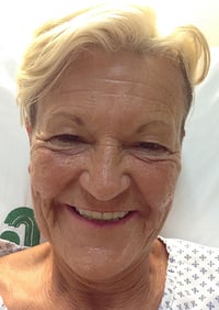 Eyelid Lift