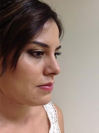 Rhinoplasty